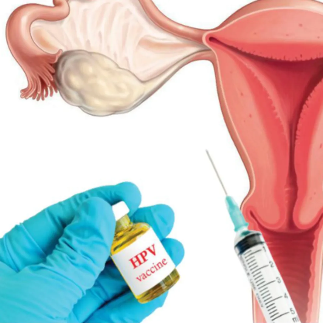 加卫苗 9 — 9价HPV疫苗